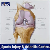 Sports Injury and Arthritis Centre