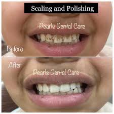 Pearls Advanced Dental Care