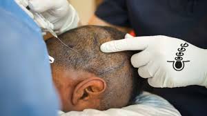 Manchanda’s Dental & Hair Transplant